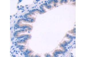 Figure. (TPSAB1 antibody  (AA 149-273))
