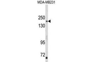Western blot analysis of TBC1D4 Antibody (N-term) in MDA-MB231 cell line lysates (35ug/lane).