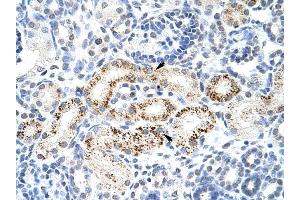 PPP1R8 antibody was used for immunohistochemistry at a concentration of 4-8 ug/ml to stain Epithelial cells of renal tubule (arrows) in Human Kidney.