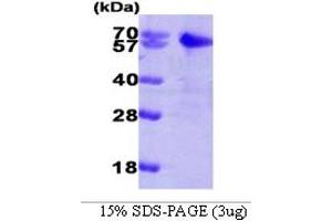 SDS-PAGE (SDS) image for SMAD, Mothers Against DPP Homolog 2 (SMAD2) (AA 1-467) protein (His tag) (ABIN667736)
