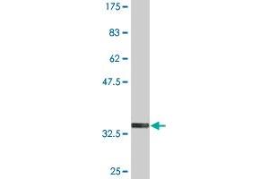 Western Blot detection against Immunogen (35. (FOLR2 antibody  (AA 36-128))