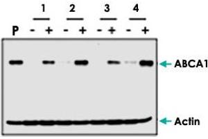 Western blot analysis of ABCA1 induction by cholesterol (+) in human fibroblast cells from different patients (1, 2, 3, 4). (ABCA1 antibody  (AA 1800-2260))