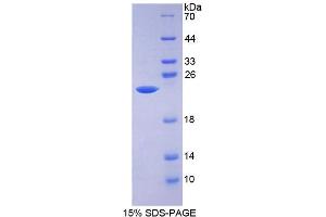 Image no. 1 for Aldehyde Dehydrogenase 9 Family, Member A1 (ALDH9A1) (AA 322-494) protein (His tag) (ABIN4990317)