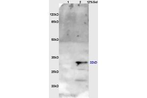Lane 1: myeloma cell s/p20 lysates Lane 2: mouse brain lysates probed with Anti OTX1 + OTX2 Polyclonal Antibody, Unconjugated (ABIN1387702) at 1:200 in 4 °C. (Otx1 + Otx2 (AA 21-120) antibody)