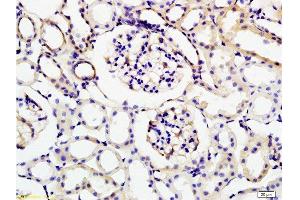 Formalin-fixed and rat kidney tissue labeled with Anti-KLK1 Polyclonal Antibody , Unconjugated at 1:200 followed by conjugation to the secondary antibody and DAB staining (Kallikrein 1 antibody  (AA 101-200))