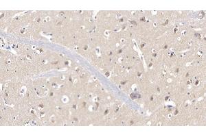 Detection of CDK1 in Human Cerebrum Tissue using Polyclonal Antibody to Cyclin Dependent Kinase 1 (CDK1) (CDK1 antibody  (AA 59-182))