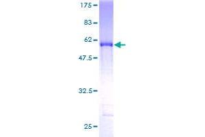 Image no. 1 for SH3 Domain Binding Glutamic Acid-Rich Protein (SH3BGR) (AA 1-239) protein (GST tag) (ABIN1319879) (SH3BGR Protein (AA 1-239) (GST tag))