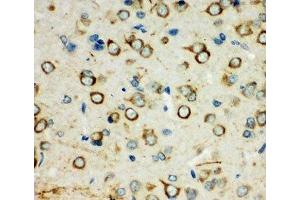 IHC-P: XRCC3 antibody testing of rat brain tissue (XRCC3 antibody  (C-Term))