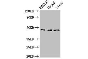 Western Blot Positive WB detected in: HEK293 whole cell lysate, HepG2 whole cell lysate, Rat liver tissue All lanes: ACADSB antibody at 3 μg/mL Secondary Goat polyclonal to rabbit IgG at 1/50000 dilution Predicted band size: 48, 37 kDa Observed band size: 48 kDa