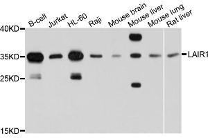 Western blot analysis of extracts of various cell lines, using LAIR1 antibody (ABIN4904190) at 1:1000 dilution. (LAIR1 antibody)