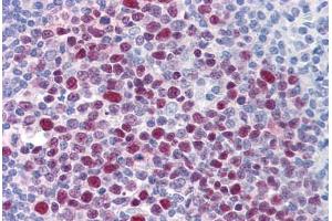 Human Tonsil: Formalin-Fixed, Paraffin-Embedded (FFPE) (EPSTI1 antibody  (AA 1-101))