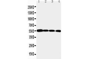 Anti-MMP24 antibody, Western blotting Lane 1: PANC Cell Lysate Lane 2: HELA Cell Lysate Lane 3: SMMC Cell Lysate Lane 4: A549 Cell Lysate (MMP24 antibody  (N-Term))