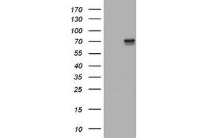 Image no. 6 for anti-Tumor Necrosis Factor Receptor Superfamily, Member 8 (TNFRSF8) (AA 19-379) antibody (ABIN1491087) (TNFRSF8 antibody  (AA 19-379))