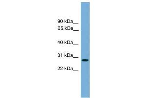 Human Jurkat; WB Suggested Anti-APOLD1 Antibody Titration: 0. (APOLD1 antibody  (Middle Region))