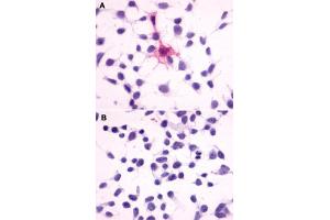Immunocytochemistry (ICC) staining of HEK293 human embryonic kidney cells transfected (A) or untransfected (B) with MC4R. (MC4R antibody  (Extracellular Domain))