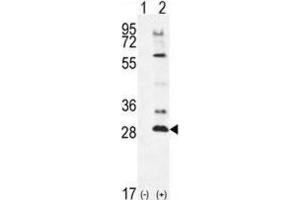 Western Blotting (WB) image for anti-Testis Specific Serine Kinase 4 (TSSK4) antibody (ABIN2996104) (TSSK4 antibody)