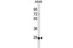 Western Blotting (WB) image for anti-Ras-Like Without CAAX 2 (RIT2) antibody (ABIN2998826) (RIT2 antibody)