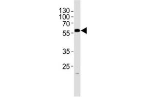 Western blot analysis of lysate from mouse testis tissue lysate using PHF1 antibody at 1:1000. (PHF1 antibody  (N-Term))