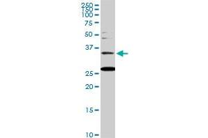 BARHL1 monoclonal antibody (M01), clone 2B11. (BARHL1 antibody  (AA 55-154))