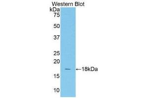 Western Blotting (WB) image for anti-Transcription Factor 20 (TCF20) (AA 1656-1792) antibody (ABIN1860688)
