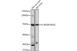 Western blot analysis of extracts of various cell lines, using N-WASP/N-WASP/WASL Rabbit mAb (ABIN7268856) at 1:1000 dilution. (Neural Wiskott-Aldrich syndrome protein (WASL) antibody)