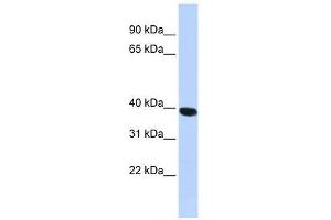 Western Blot showing HYAL1 antibody used at a concentration of 1. (HYAL1 antibody  (N-Term))