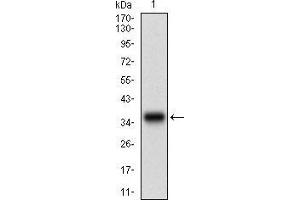 Western blot analysis using CSNK2B mAb against human CSNK2B (AA: FULL(1-215)) recombinant protein. (CSNK2B antibody  (AA 1-215))