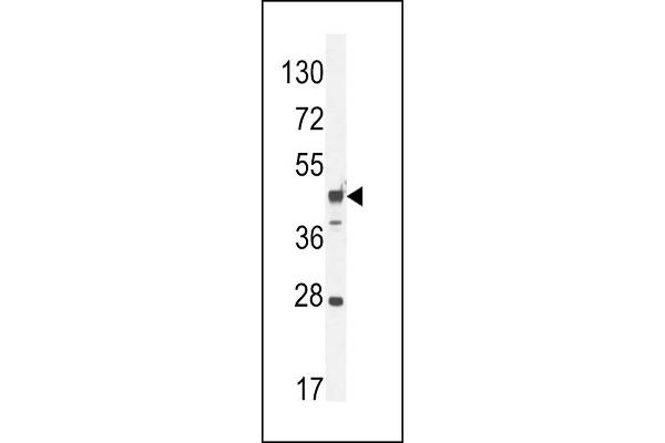 RILPL1 antibody  (C-Term)