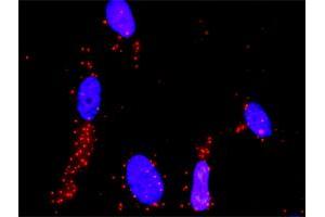 Proximity Ligation Analysis of protein-protein interactions between MAP2K3 and MAP3K4. (MAP3K4 antibody  (AA 1201-1300))