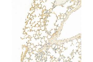 ABIN6261536 and ABIN6266485 at 1/100 staining Mouse lung tissue by IHC-P.