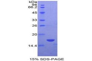 SDS-PAGE (SDS) image for Non Metastatic Cells 4, Protein NM23A Expressed In (AA 67-185) protein (His tag) (ABIN1878402)