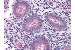 Human Uterus: Formalin-Fixed, Paraffin-Embedded (FFPE) (ELP3/KAT9 antibody)