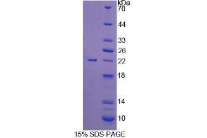 SDS-PAGE (SDS) image for Uridine Monophosphate Synthetase (UMPS) (AA 311-481) protein (His tag) (ABIN6238892) (UMPS Protein (AA 311-481) (His tag))
