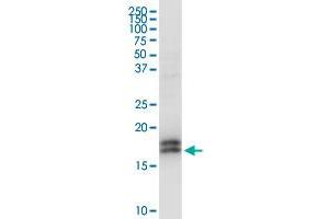 NPC2 MaxPab rabbit polyclonal antibody. (NPC2 antibody  (AA 1-151))