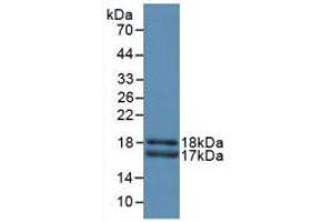 Western blot analysis of recombinant Rat CEACAM1. (CEACAM1 antibody  (AA 36-145))