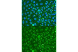 Immunofluorescence analysis of A549 cell using SRGN antibody. (SRGN antibody)