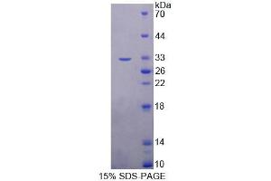 SDS-PAGE analysis of Human TOP3b Protein.
