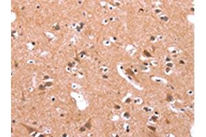 The image on the left is immunohistochemistry of paraffin-embedded Human brain tissue using ABIN7190731(GABRA1 Antibody) at dilution 1/30, on the right is treated with synthetic peptide. (GABRA1 antibody)