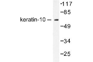 Image no. 1 for anti-Keratin 10 (KRT10) antibody (ABIN265492) (Keratin 10 antibody)