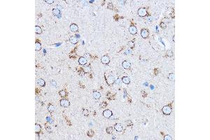 Immunohistochemistry (IHC) image for anti-Cathepsin B (CTSB) (AA 1-339) antibody (ABIN3021176)
