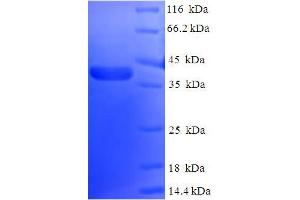 SDS-PAGE (SDS) image for Nucleolar Protein 3 (Apoptosis Repressor with CARD Domain) (NOL3) (AA 1-208) protein (His-SUMO Tag) (ABIN5710017)