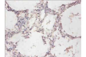 Immunohistochemistry of paraffin-embedded human lung tissue using ABIN7160982 at dilution of 1:100 (CYB5R3 antibody  (AA 1-301))