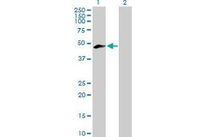 Western Blot analysis of MEIS3 expression in transfected 293T cell line by MEIS3 MaxPab polyclonal antibody. (MEIS3 antibody  (AA 1-421))