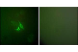 Immunofluorescence analysis of A549 cells, using PTGS2 antibody (ABIN5976369). (PTGS2 antibody  (C-Term))