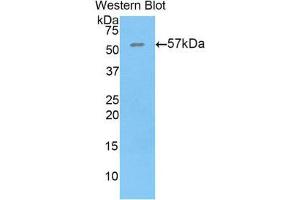Western Blotting (WB) image for anti-Thrombospondin 4 (THBS4) (AA 662-923) antibody (ABIN1860747) (THBS4 antibody  (AA 662-923))