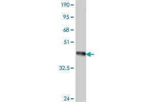 Western Blot detection against Immunogen (37. (IL17 Receptor B antibody  (AA 18-117))