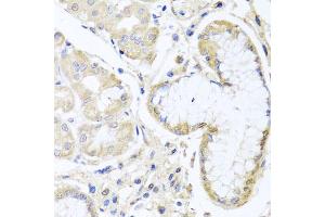 Immunohistochemistry of paraffin-embedded human stomach using INPP5K antibody (ABIN5975191) at dilution of 1/100 (40x lens).