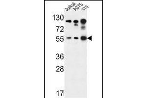 AKT1- antibody j western blot analysis in Jurkat,,Y79 cell line lysates (35 μg/lane). (AKT1 antibody  (AA 107-135))