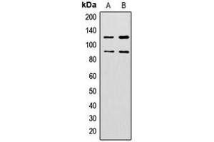 Western blot analysis of ZNF148 expression in HeLa (A), HepG2 (B) whole cell lysates. (ZNF148 antibody  (N-Term))