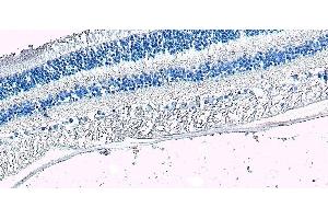 Immunohistochemistry (IHC) image for anti-Arrestin 3, Retinal (X-Arrestin) (ARR3) (C-Term) antibody (ABIN570667)